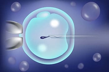 What is ICSI and how it is different from IVF